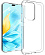 PICTURE_SMALL