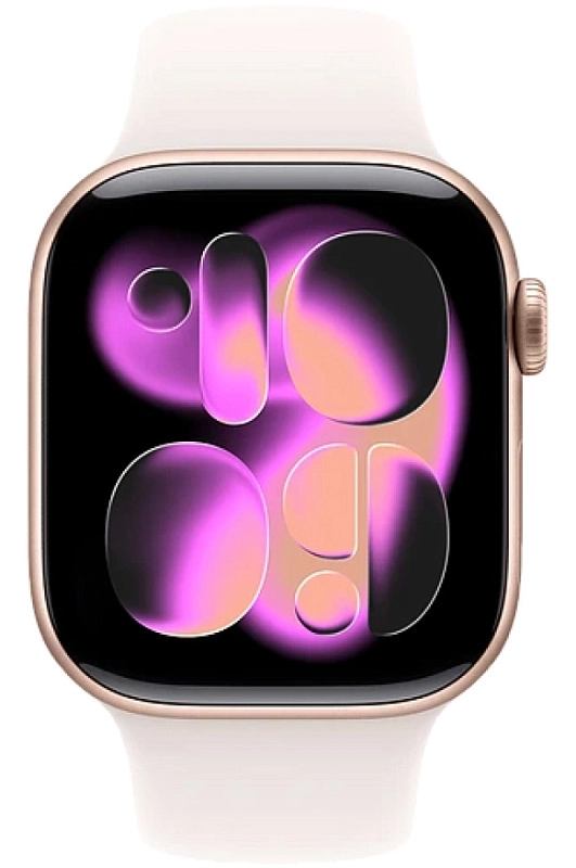 Apple Watch 11 46 мм (золото/розовый, S/M) фото 1
