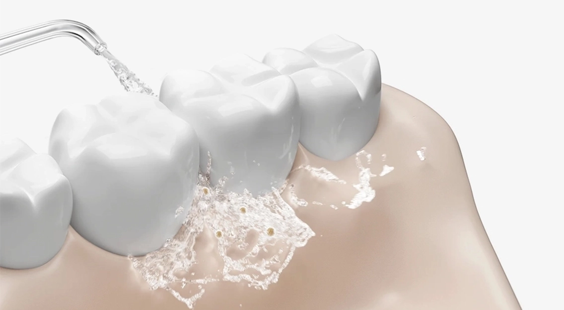 Ирригатор-Xiaomi-Water-Flosser-2-22.jpg